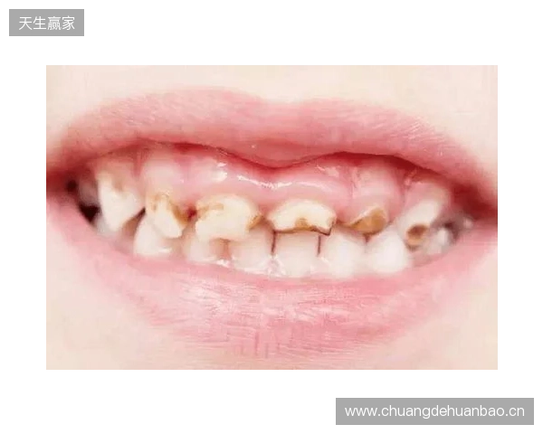 韦林顿确诊上唇部贯通伤；11、21牙半脱位；上颌前牙区牙槽骨骨折