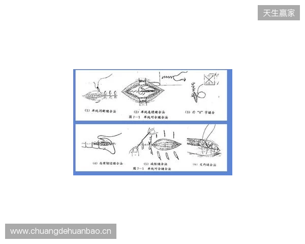 广州豹官方:杨浩眉弓伤口缝合30余针,预计5-7天后拆线 广州豹官方:杨浩眉弓伤口缝合30余针,预计5-7天后拆线